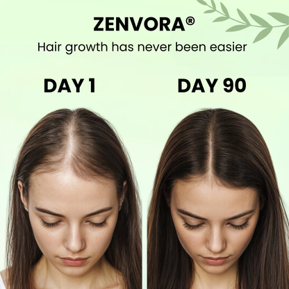 Anti-Hair Loss Treatment Shampoo