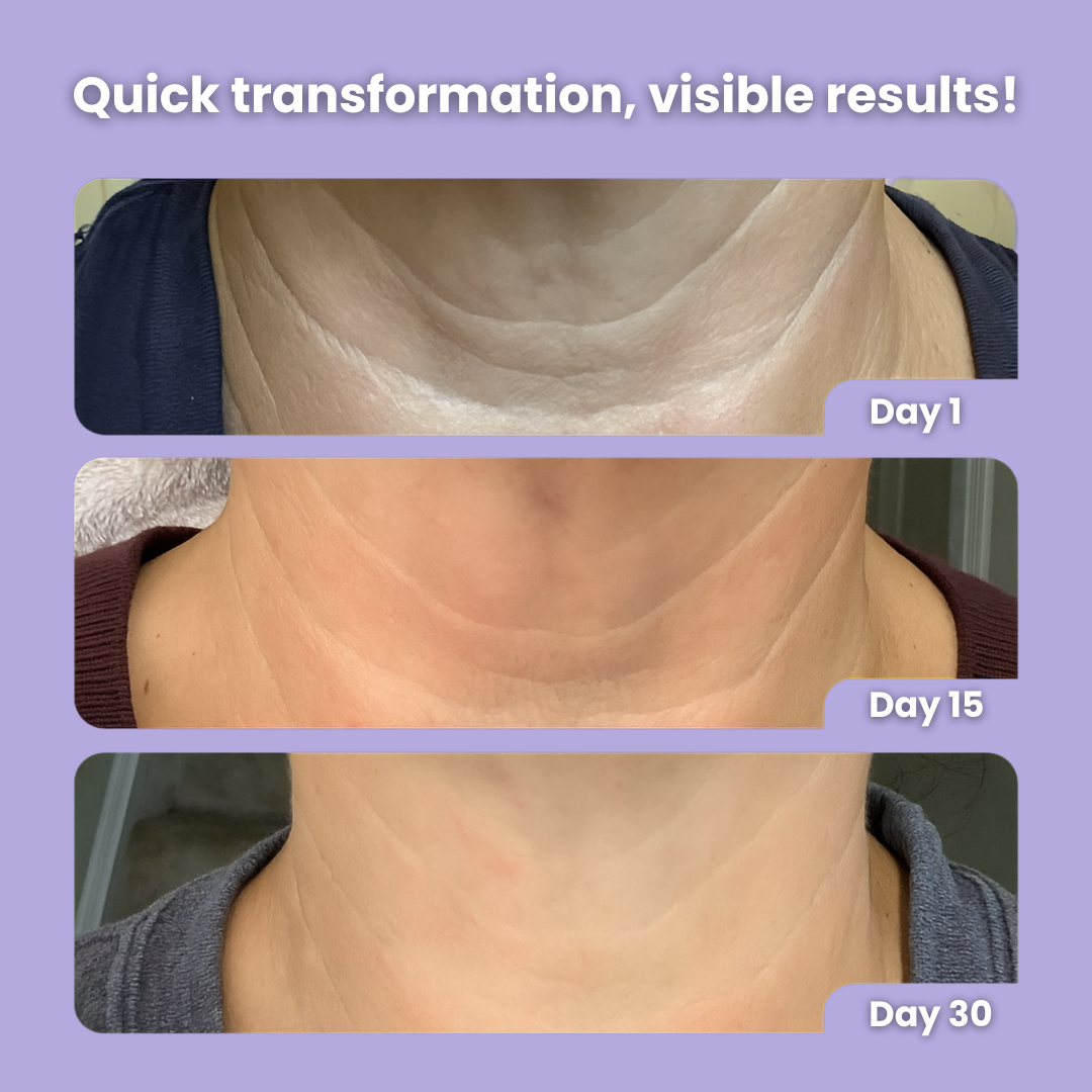 Neck Tightening Cream