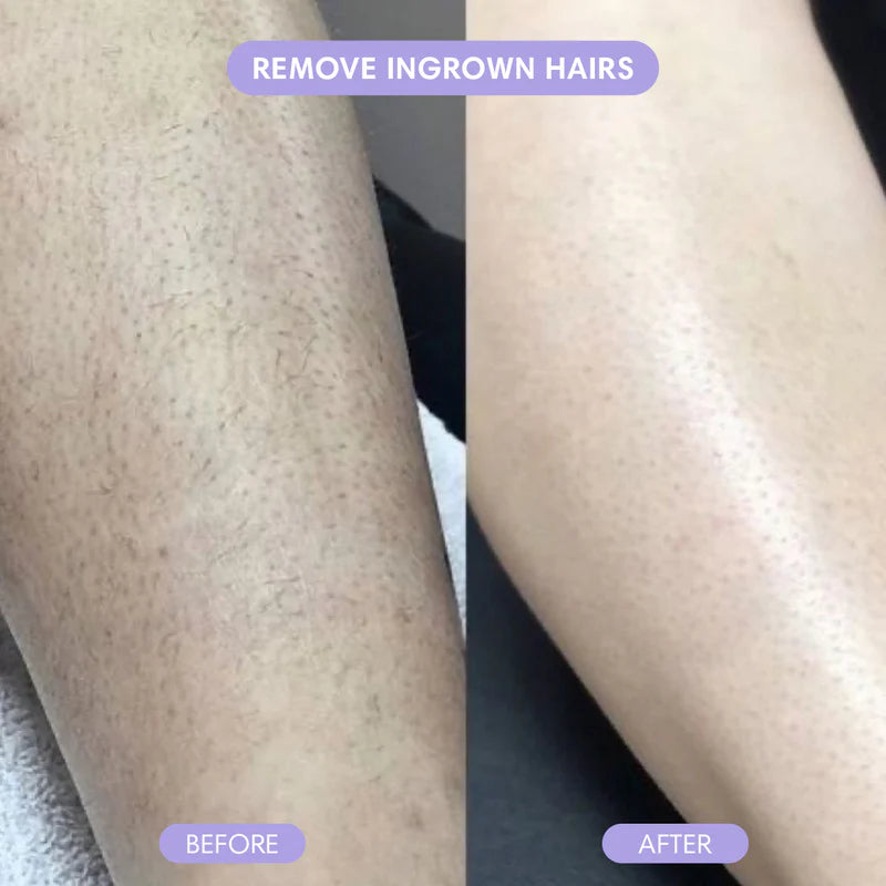 Painless Hair Removal Cream